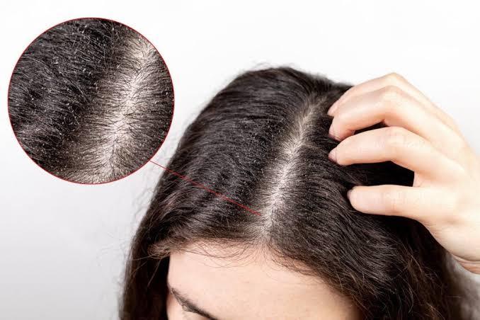 Doenças do couro cabeludo