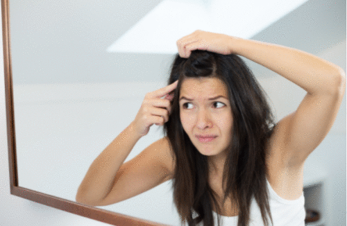 Tricose: Caspas em cabelos secos