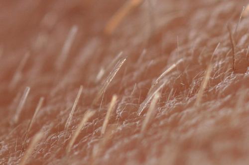 Tipos de pelos: Vellos, lanugo e terminal